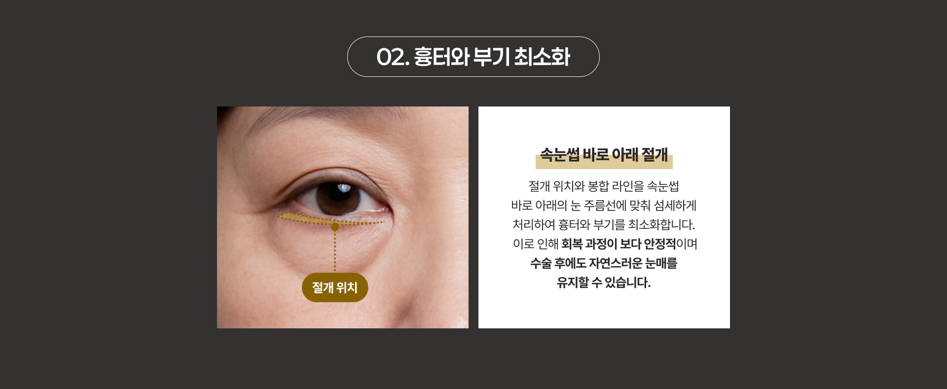 02. 흉터와 부기 최소화