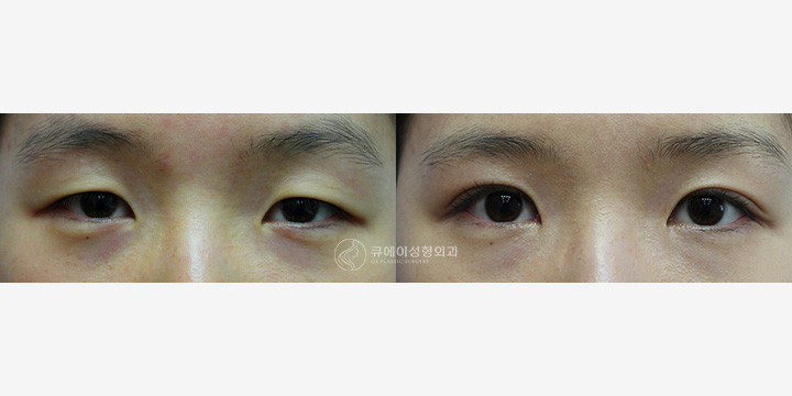 윗트임2.jpg